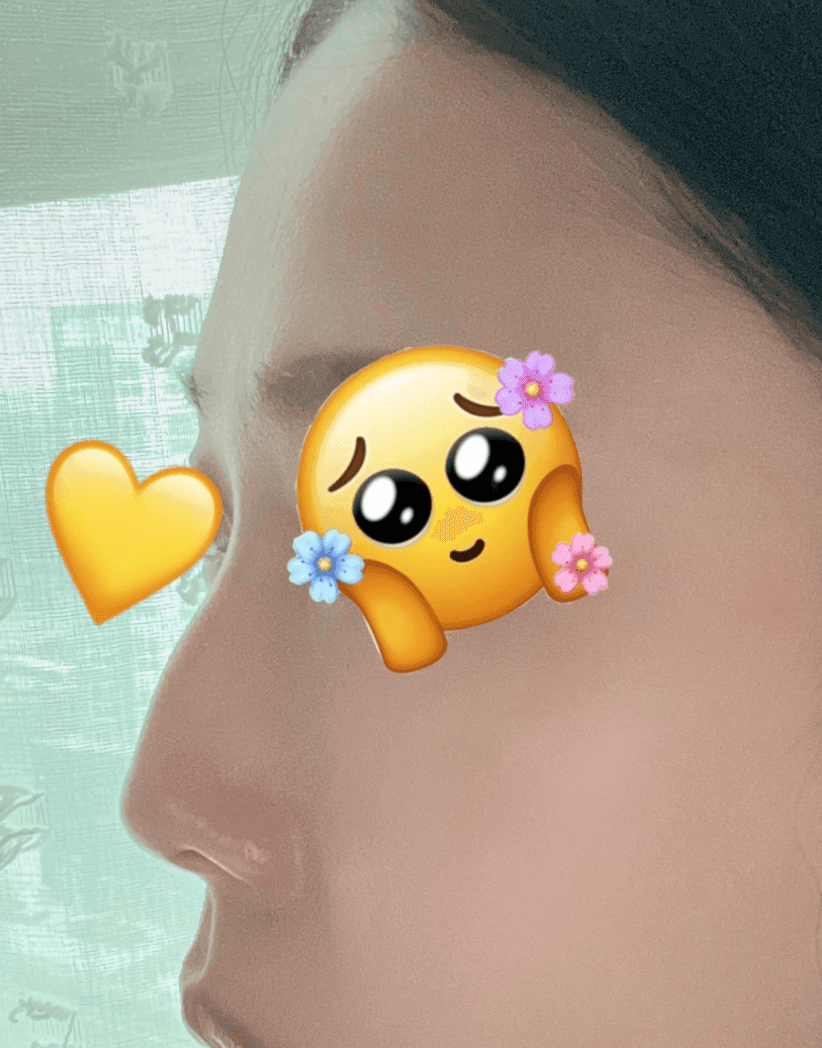 매부리코교정과 비염수술을 함께 진행한 사례 — 무보형물·귀연골로 계획한 이유 관련 이미지 2/14