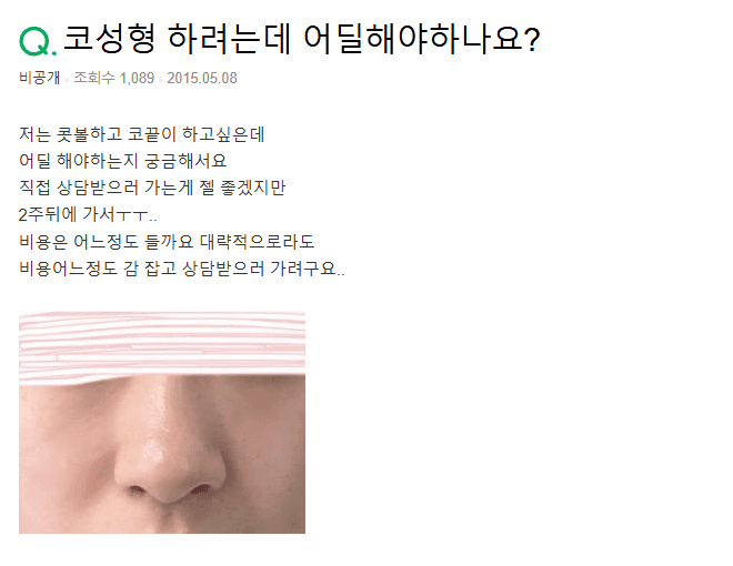 매부리코에 비중격 연장이 필요한 경우 — 긴 코·휜 콧대를 함께 보는 이유 (Q&A) 관련 이미지 2/3