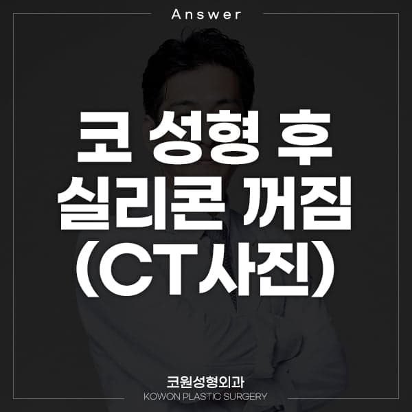 매부리코 수술 후 CT에서 실리콘이 꺼져 보인다면 — 겉은 멀쩡한데 왜 그럴까 관련 이미지 1/2