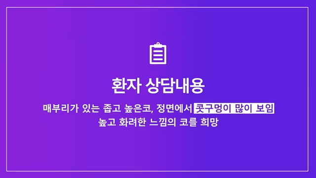 매부리코 교정 사례 — 실·필러를 먼저 제거해야 했던 이유와 2주차 경과 관련 이미지 2/8
