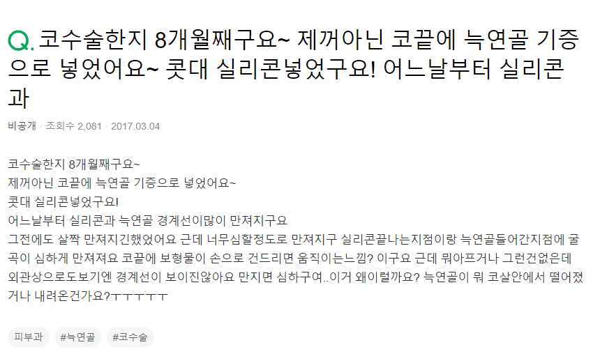 코수술 8개월, 실리콘과 기증늑연골의 경계가 만져진다면 — 걱정할 문제인지 확인하는 기준 관련 이미지 2/2