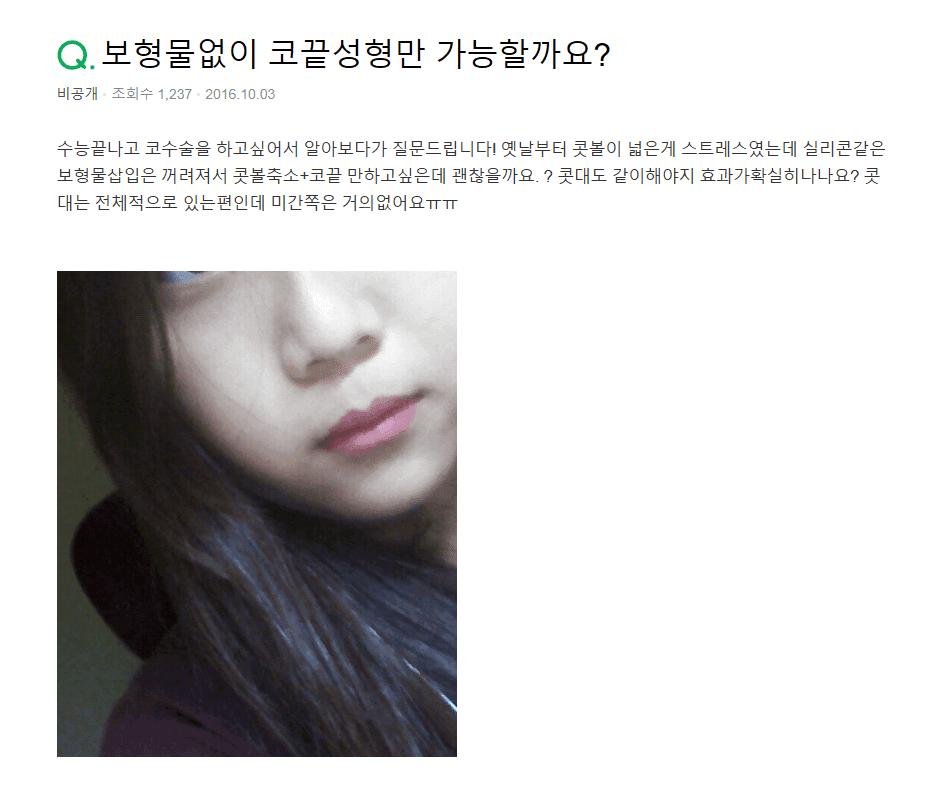 보형물 없이 콧볼축소, 가능할까요 — 코끝 중심과 비주로 판단하는 기준 관련 이미지 2/10
