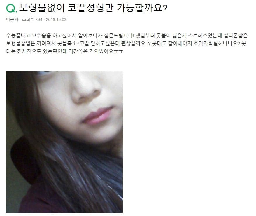 무보형물 코수술로 콧볼축소와 코끝 성형이 가능할까 — 콧대가 있다면 답이 달라집니다 관련 이미지 2/3