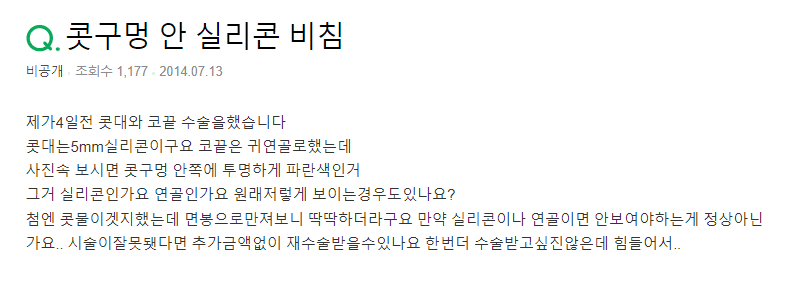 코수술 후 콧구멍 안에 보이는 투명한 것, 실리콘인가요 연골인가요 관련 이미지 2/3
