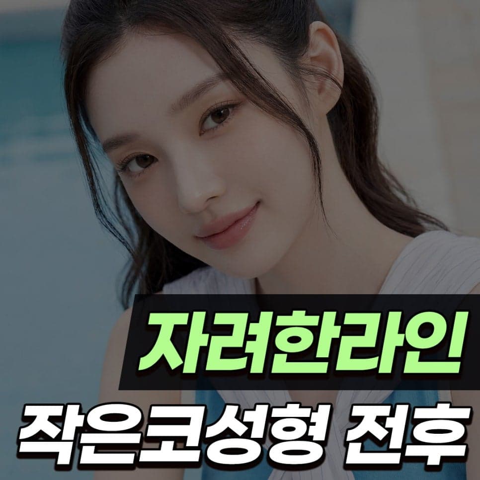 ศัลยกรรมจมูก เป็นธรรมชาติแต่คมชัดคืออะไร? — ภาพที่เกี่ยวข้อง 1/10 ของกรณีจมูกเล็กที่สร้างรูปทรงโดยไม่ใช้อิมแพลนต์หลังจากเอาไหมและฟิลเลอร์ออก