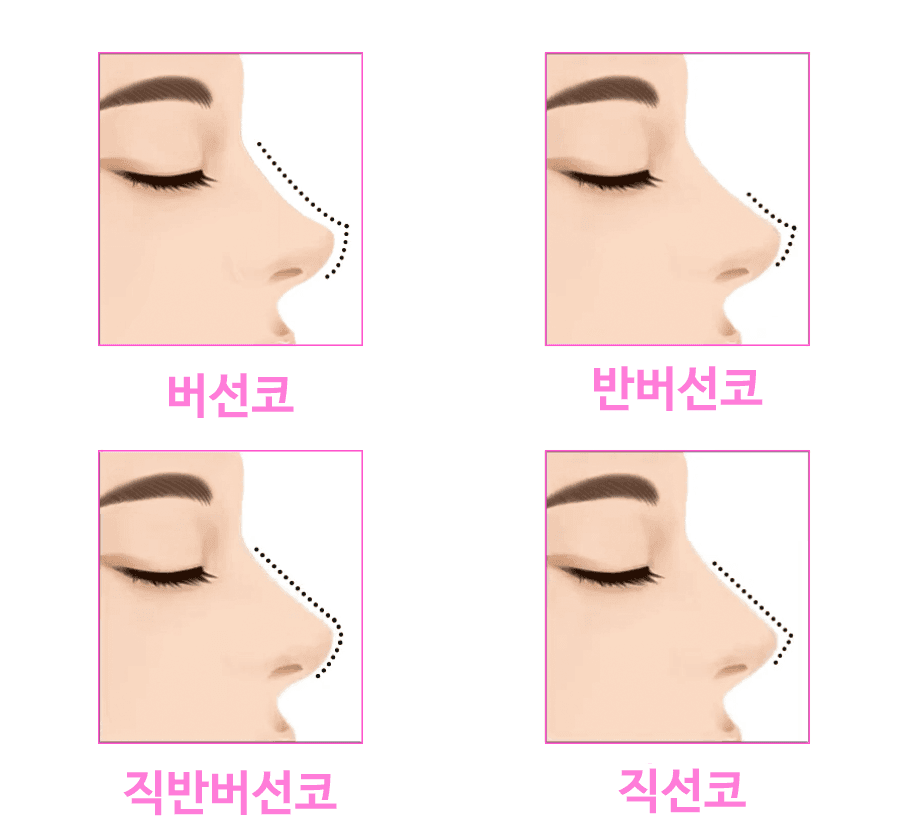 직반버선코, 직선과 곡선의 균형은 어떻게 잡나요 — 콧구멍 비대칭 동반 시 확인 순서 관련 이미지 2/9