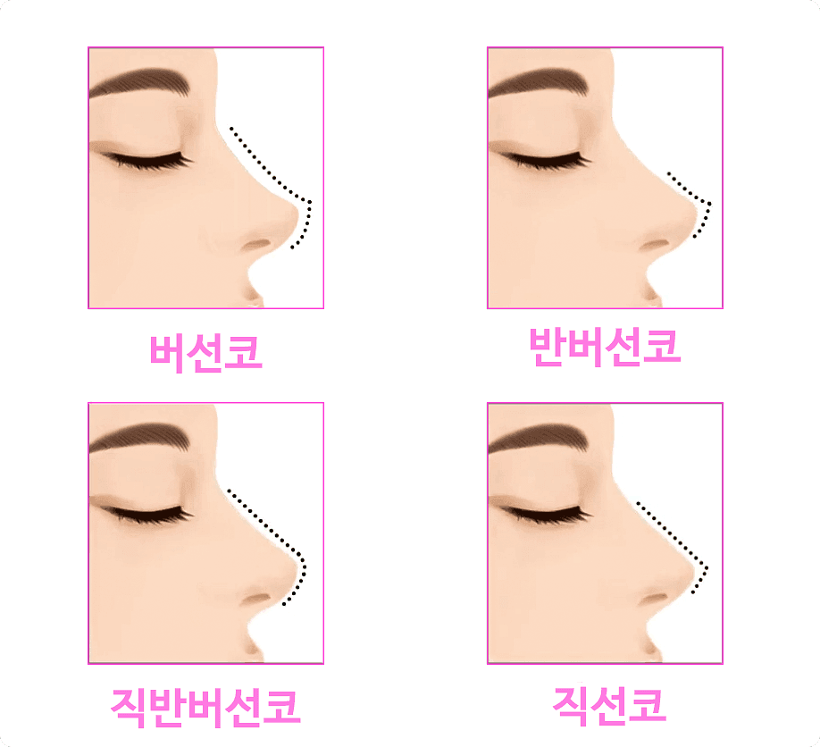 직반라인(직반버선코), 자연스러움은 왜 디자인에서 결정되나 — 콧대·코끝·비순각 관련 이미지 2/6