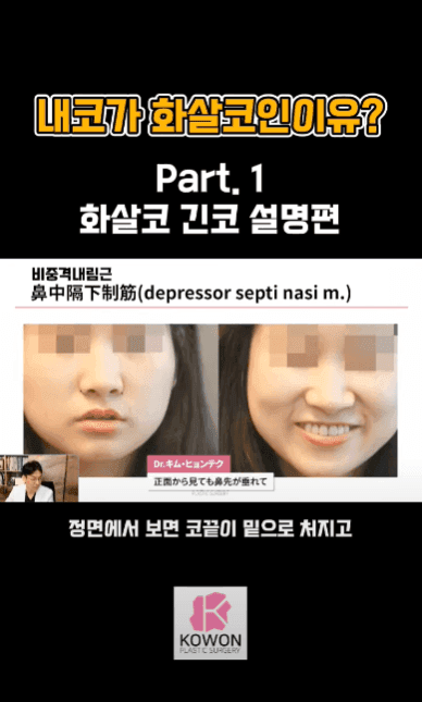 긴코수술은 어떻게 진행될까 — 처진코 원인 세 가지와 비중격·비주 조정, 회복 과정까지 관련 이미지 6/15