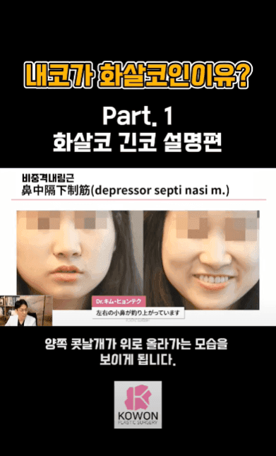 긴코수술은 어떻게 진행될까 — 처진코 원인 세 가지와 비중격·비주 조정, 회복 과정까지 관련 이미지 7/15