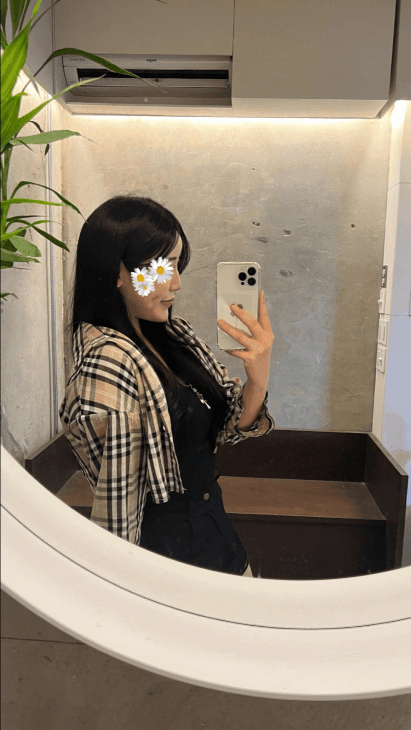 จมูกโหนกต่ำและสันจมูกไม่เรียบ — กรณีที่ทำการแก้ไขความสูงและแนวสันจมูกโดยใช้กระดูกอ่อนซี่โครงของตนเองภาพที่เกี่ยวข้อง 5/23
