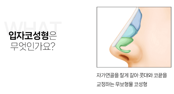 낮은코성형, 높이보다 조화 — 자연스러운 입체감을 결정하는 확인 순서 관련 이미지 5/7
