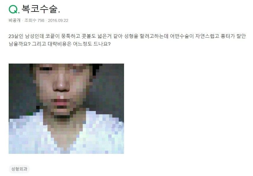 남자 복코, 콧볼축소하면 흉터가 남나요 — 지식iN 질문으로 본 수술 구분 관련 이미지 2/2