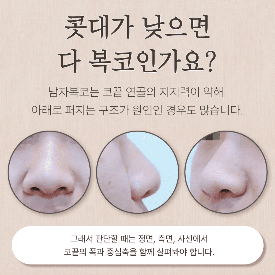 남자 복코, 코끝만 세우면 될까 — 구조 판단과 병원 선택의 네 가지 기준 관련 이미지 2/8