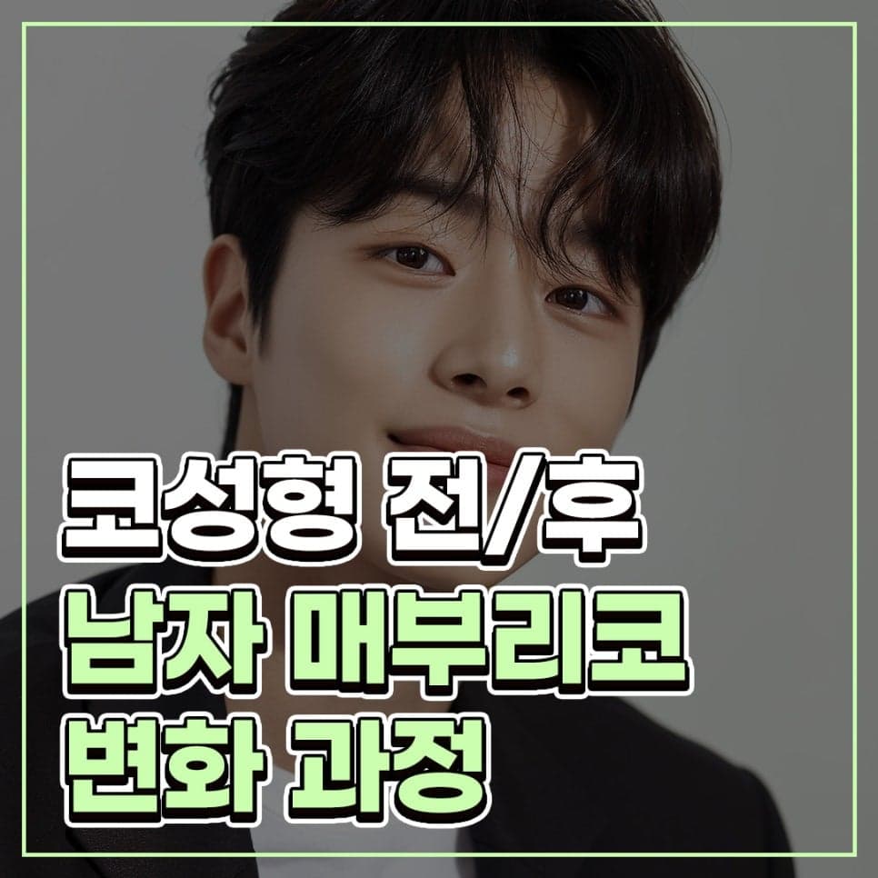남자 매부리코 수술, 콧대와 코끝을 함께 보는 이유 — 튀어나온 부분만 다듬으면 되나요? 관련 이미지 1/7