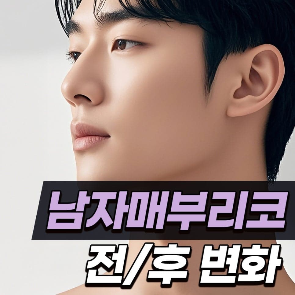 남자 매부리코 수술, 인상은 어떻게 달라지나요 — 전후 변화와 회복기간 관련 이미지 1/8