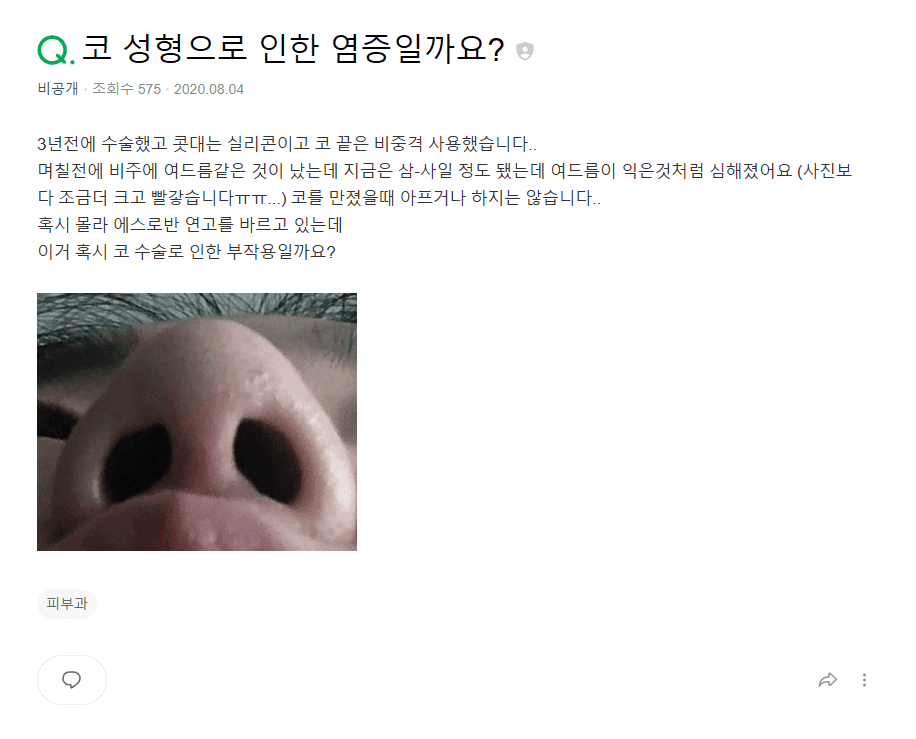코성형 3년 뒤 비주에 생긴 여드름 같은 트러블 — 단순 피부 염증과 코성형 염증 구분하기 관련 이미지 2/10