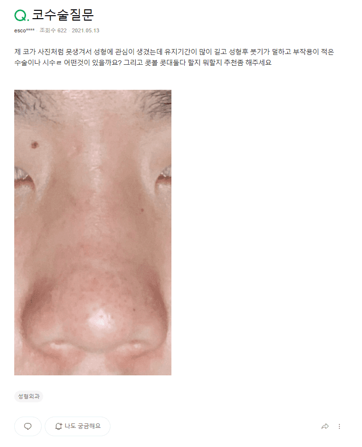 남자 코 성형, 무엇을 보고 결정하나요? — 지식iN 질문과 복코 교정 사례로 본 기준 관련 이미지 2/10