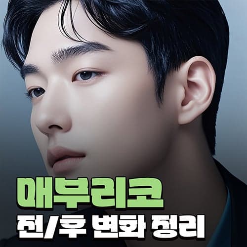 매부리코 사례로 보는 남자 코성형 라인 설계와 회복 흐름 관련 이미지 1/9