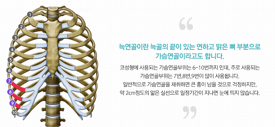 남자 코수술, 티 나지 않는 라인은 무엇을 보고 설계하나 — 라인·재료·지지력 관련 이미지 4/7