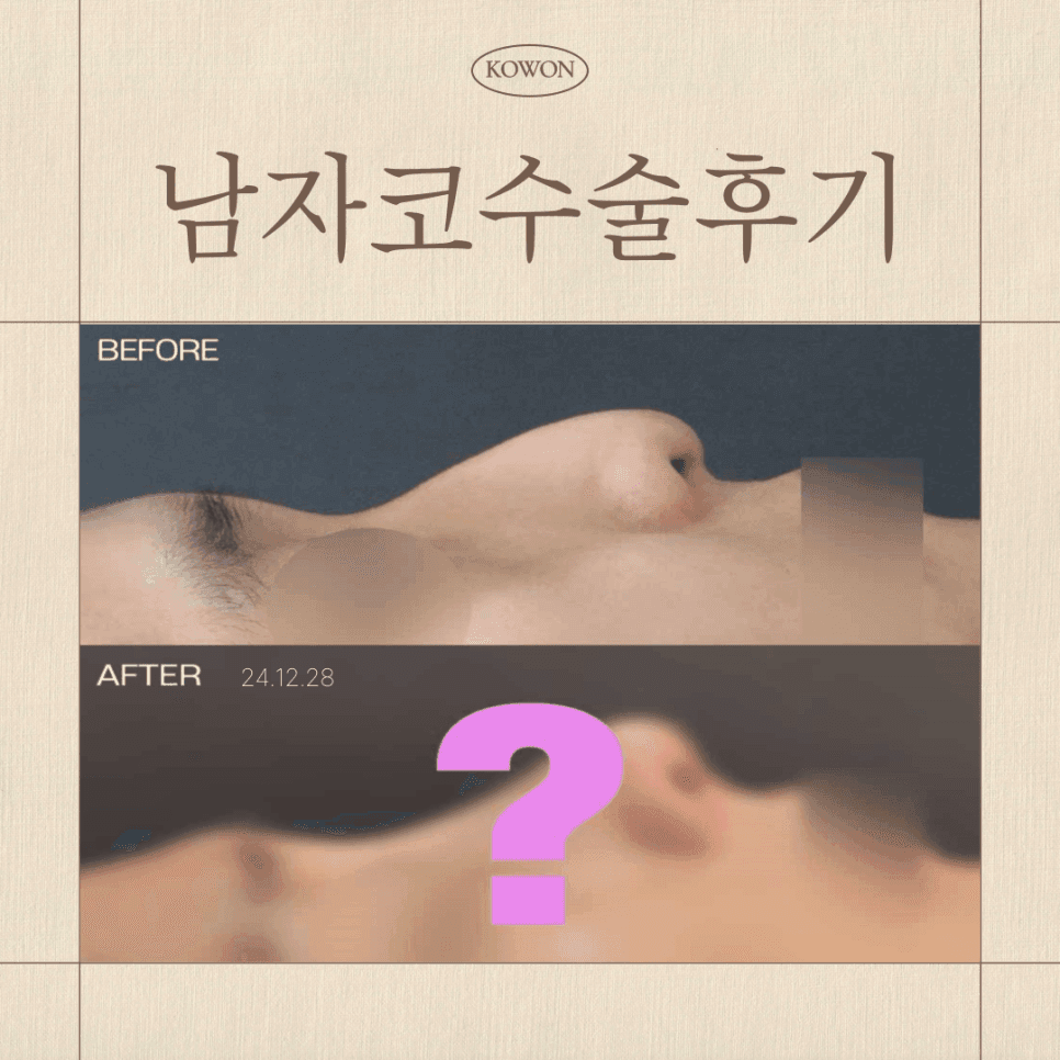 남자 직선코, 나에게도 어울릴까 — T존·재료 기준으로 판단하는 방법 관련 이미지 1/7