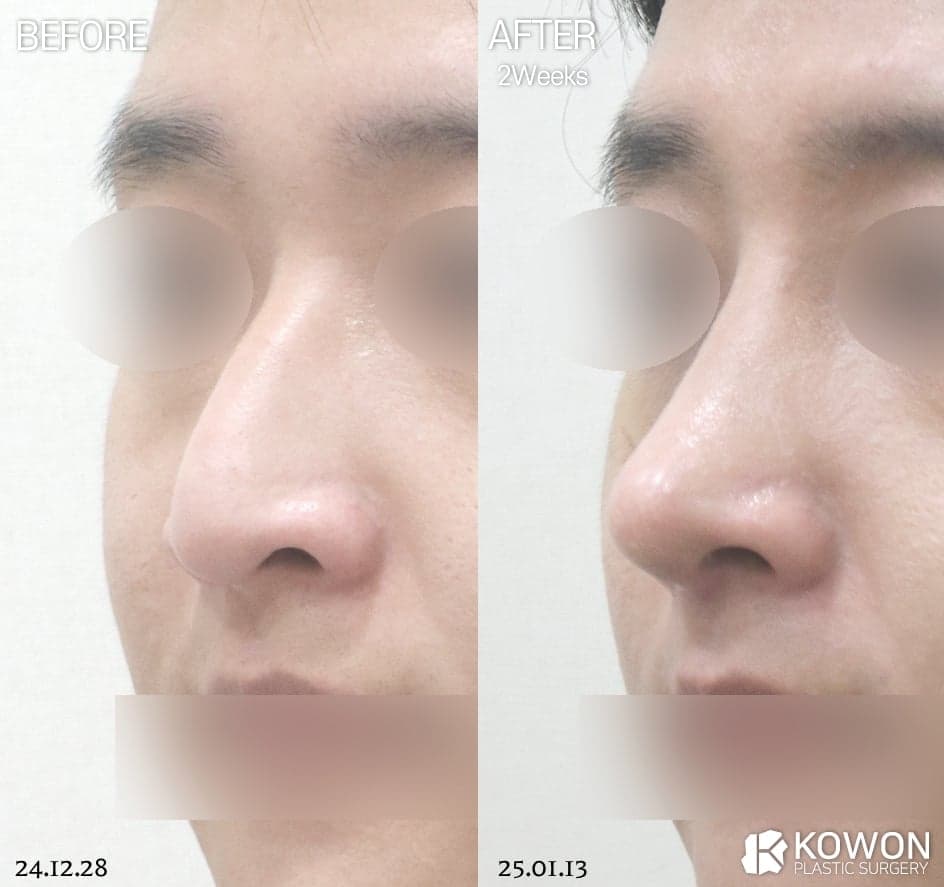 남자 직선코, 나에게도 어울릴까 — T존·재료 기준으로 판단하는 방법 관련 이미지 3/7