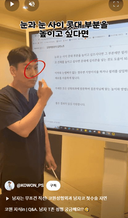 ศัลยกรรมจมูกชายและการเพิ่มปริมาตรบริเวณทีโซน — สามวิธีเสริมกันในการแบ่งส่วนหว่างสันจมูกและหน้าผาก ภาพที่เกี่ยวข้อง 2/16
