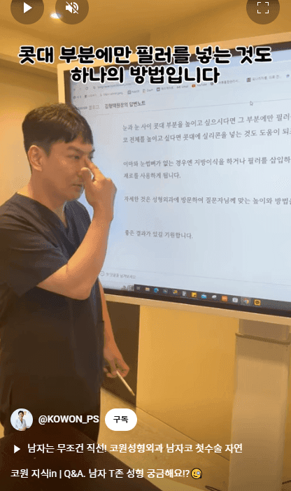 ศัลยกรรมจมูกชายและการเพิ่มปริมาตรบริเวณทีโซน — สามวิธีเสริมกันในการแบ่งส่วนหว่างสันจมูกและหน้าผาก ภาพที่เกี่ยวข้อง 3/16