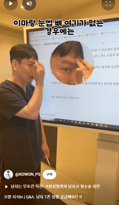 ศัลยกรรมจมูกชายและการเพิ่มปริมาตรบริเวณทีโซน — สามวิธีเสริมกันในการแบ่งส่วนหว่างสันจมูกและหน้าผาก ภาพที่เกี่ยวข้อง 6/16