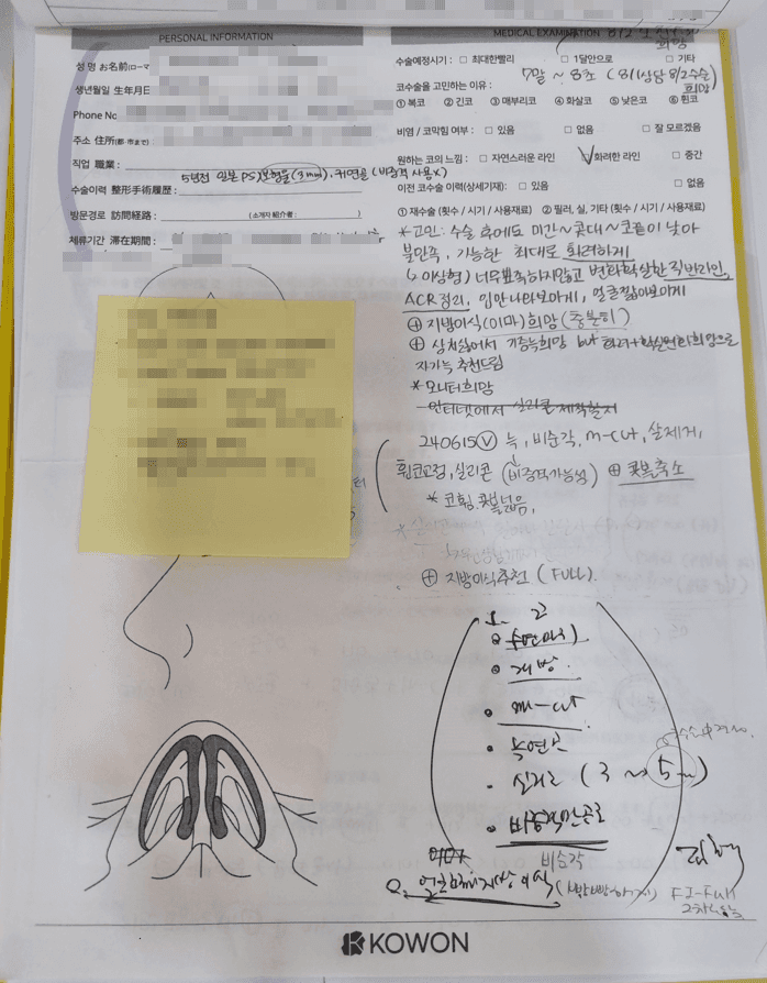 중안면 함몰, 코수술로 개선을 기대할 수 있을까 — 비순각과 지방이식을 함께 보는 이유 관련 이미지 4/6