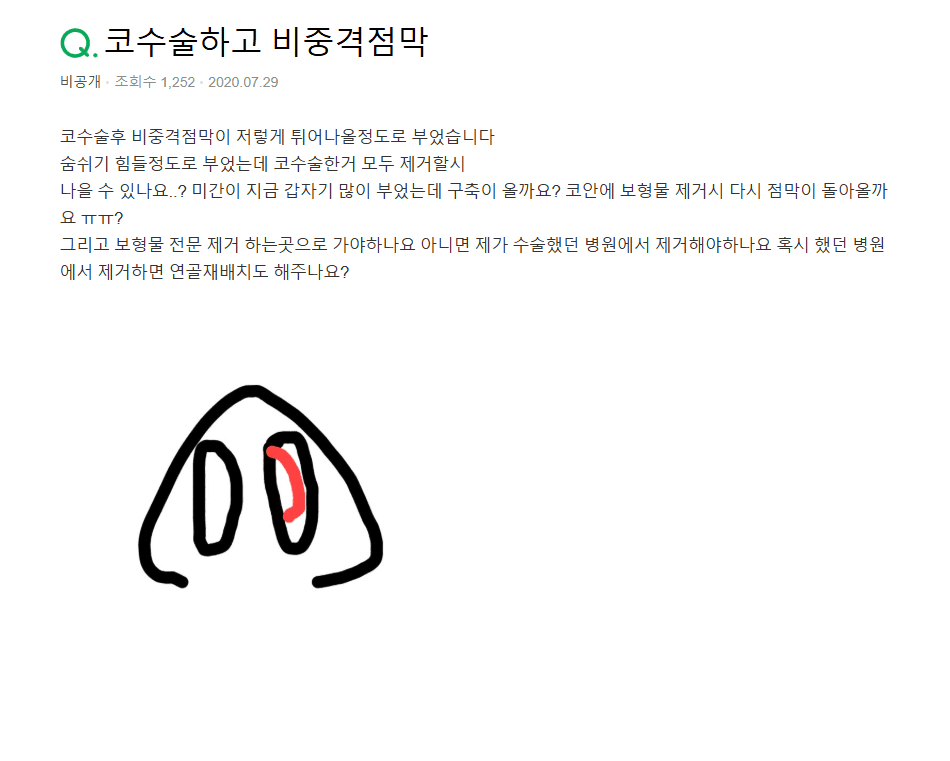 코수술 후 코안 점막이 부었다면 — 보형물 제거보다 먼저 확인해야 하는 것 관련 이미지 2/9