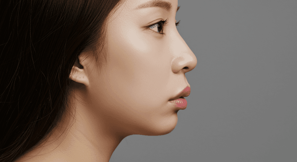 비순각 교정, 실리콘 없이도 가능한가요 — 돌출입처럼 보이는 착시와 90도의 의미 관련 이미지 1/7