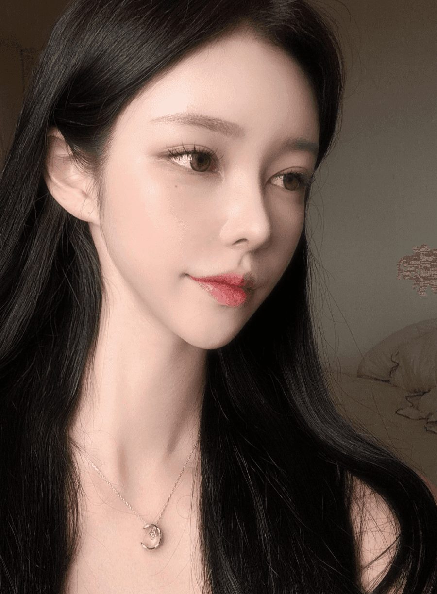 낮은코성형에서 비순각까지 본 사례 — 입이 나와 보이는 인상, 보형물 없이 다룬 이유 관련 이미지 3/13
