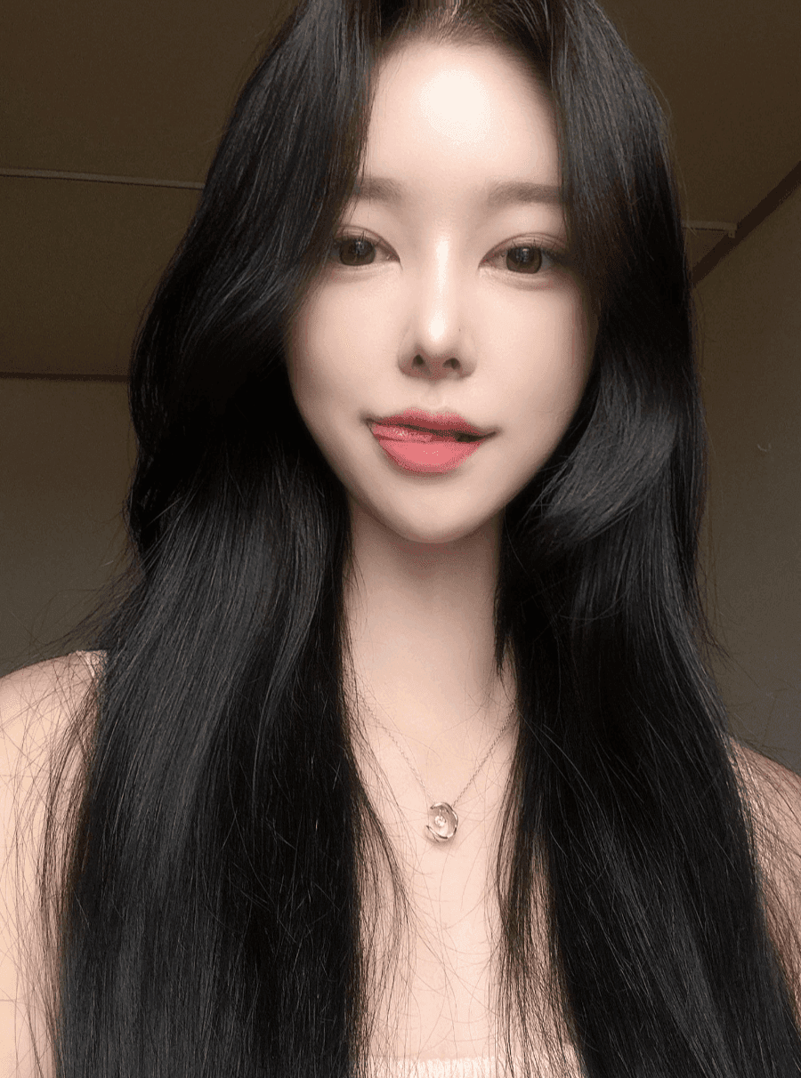 낮은코성형에서 비순각까지 본 사례 — 입이 나와 보이는 인상, 보형물 없이 다룬 이유 관련 이미지 4/13