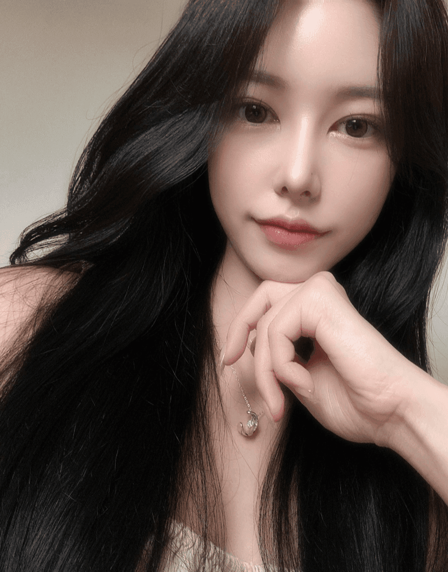 낮은코성형에서 비순각까지 본 사례 — 입이 나와 보이는 인상, 보형물 없이 다룬 이유 관련 이미지 6/13