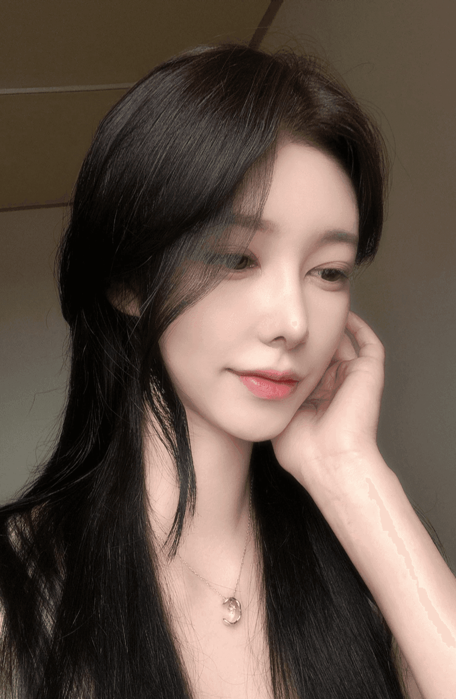 낮은코성형에서 비순각까지 본 사례 — 입이 나와 보이는 인상, 보형물 없이 다룬 이유 관련 이미지 7/13