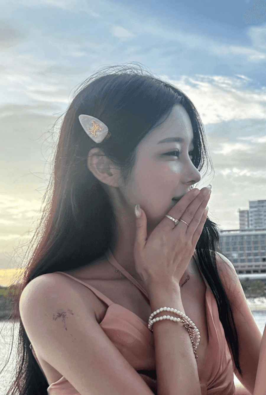 낮은코성형에서 비순각까지 본 사례 — 입이 나와 보이는 인상, 보형물 없이 다룬 이유 관련 이미지 8/13