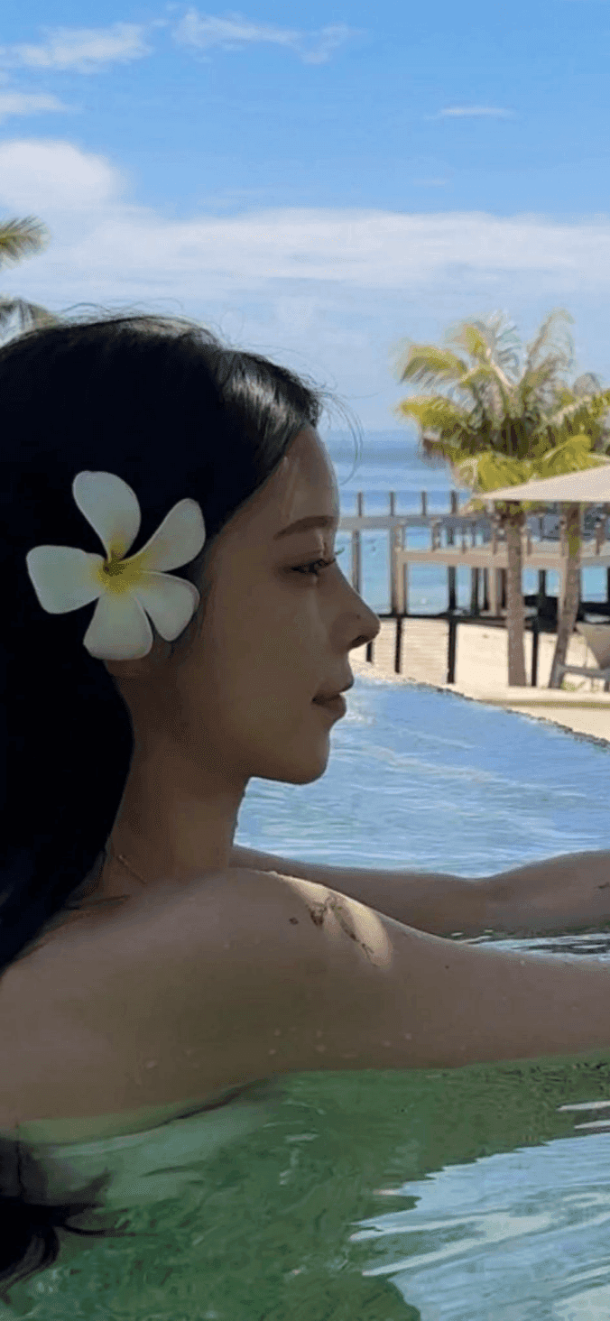낮은코성형에서 비순각까지 본 사례 — 입이 나와 보이는 인상, 보형물 없이 다룬 이유 관련 이미지 9/13