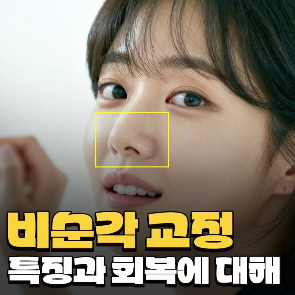 비순각교정과 단순 코높임은 무엇이 다른가요 — 코끝부터 인중까지 흐름을 보는 이유 관련 이미지 1/9