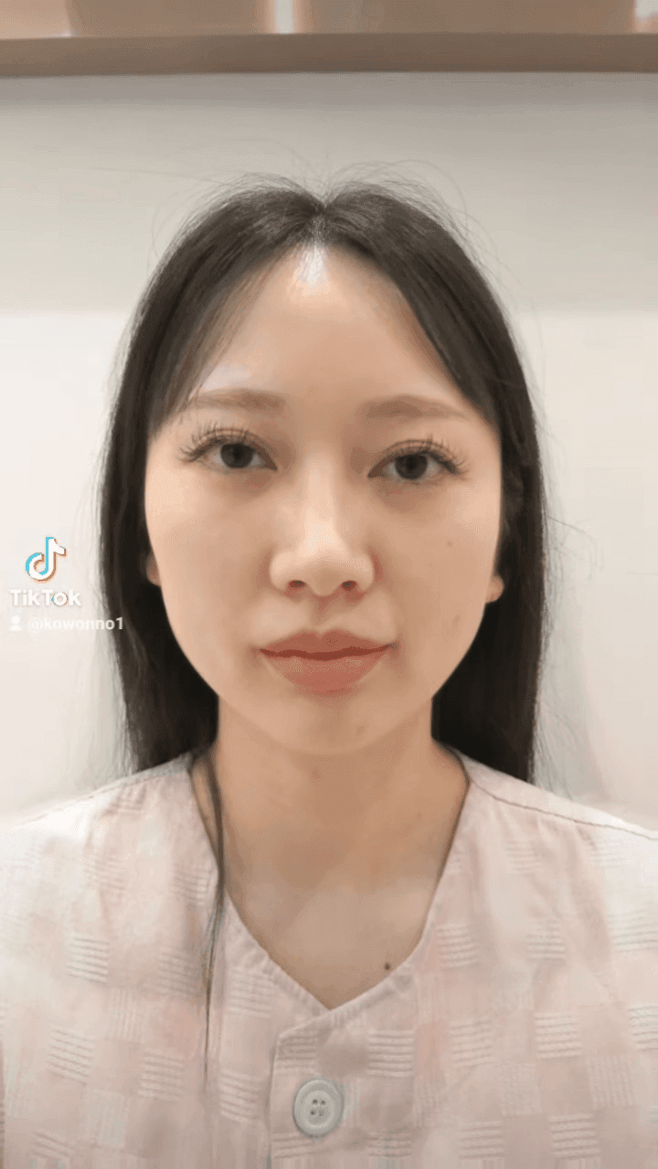 비순각수술 후 코보형물 움직임·비주붓기, 지켜봐도 될까 — 확인이 필요한 신호 관련 이미지 10/12