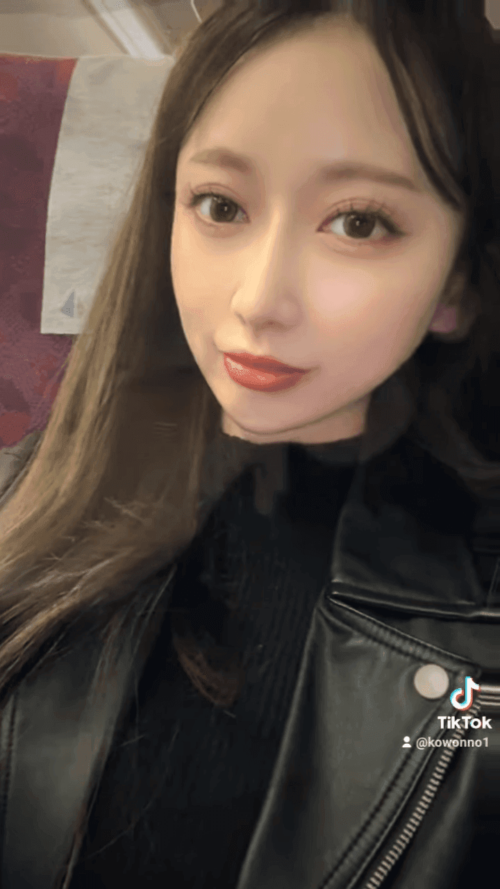 비순각수술 후 코보형물 움직임·비주붓기, 지켜봐도 될까 — 확인이 필요한 신호 관련 이미지 12/12
