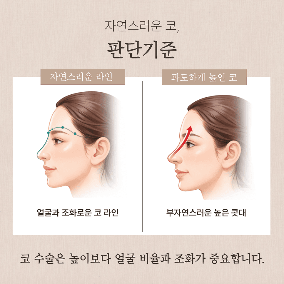 자연스러운 코를 만드는 자가늑입자 — 재료와 RIBFIT™ 리브핏 구조를 보는 기준 관련 이미지 2/8