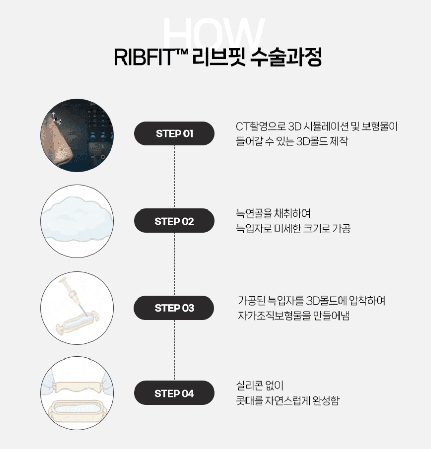티 안 나는 코성형이 목표라면 — 보형물 없이 코끝만 정리하는 방법과 RIBFIT™ 리브핏 관련 이미지 7/12