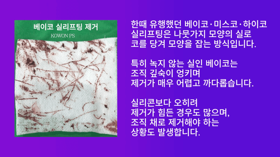 코필러·실 제거 후 재수술 — 쁘띠성형 흔적은 왜 먼저 제거해야 하나요? 관련 이미지 4/9