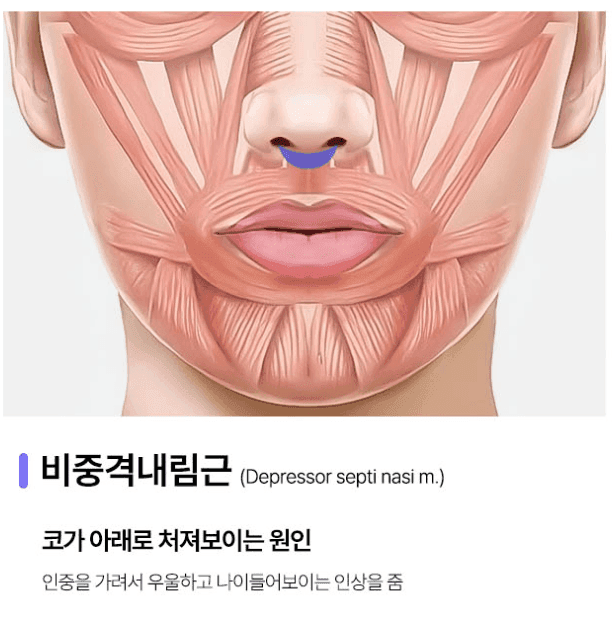 코근육교정, 웃을 때 코가 퍼져 보인다면 — 콧볼 축소만으로 부족한 이유 관련 이미지 2/5