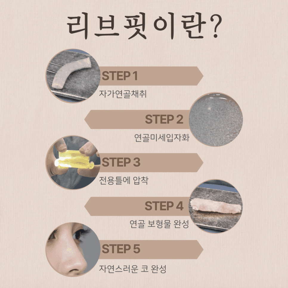 ศัลยกรรมแก้จมูก) เกณฑ์การตัดสินใจคืออะไร? — การยืนยันการเปลี่ยนแปลงโครงสร้างและเหตุผลที่ควรพิจารณา RIBFIT™ภาพที่เกี่ยวข้อง 4/8