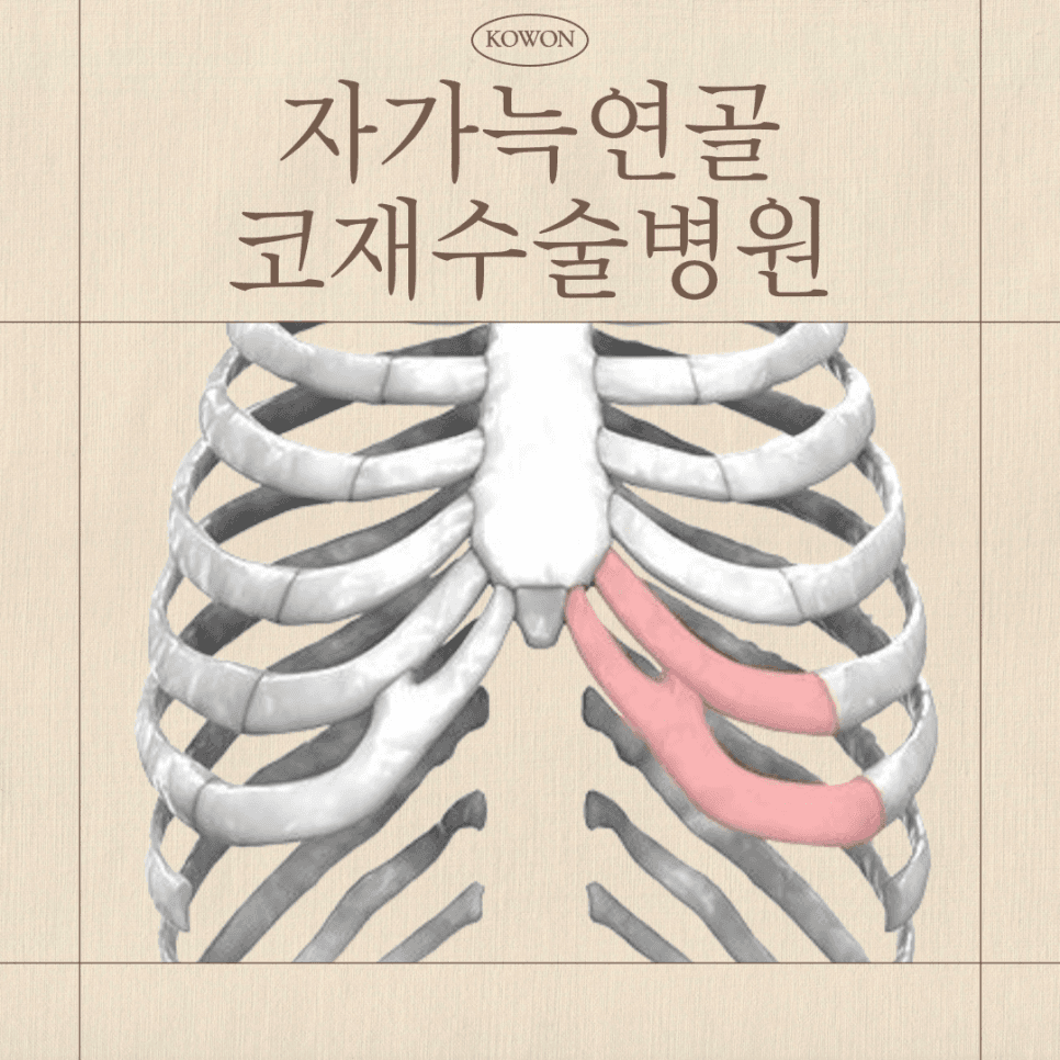 자가늑연골로 보는 코재수술 판단 포인트 — 점검 시점, 재료 조건, 병원 선택 기준 관련 이미지 1/6