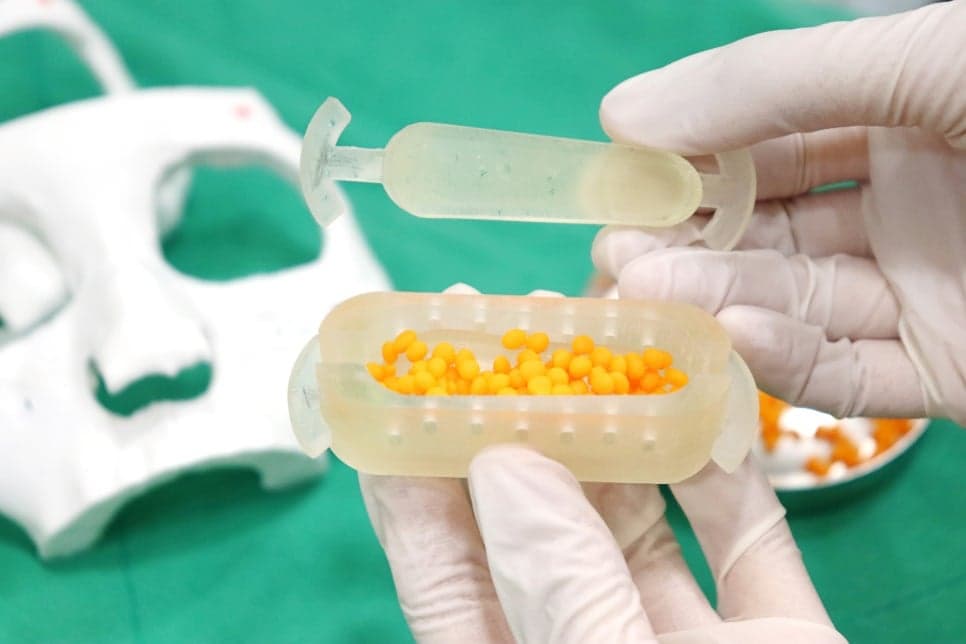 자가늑연골로 보는 코재수술 판단 포인트 — 점검 시점, 재료 조건, 병원 선택 기준 관련 이미지 4/6