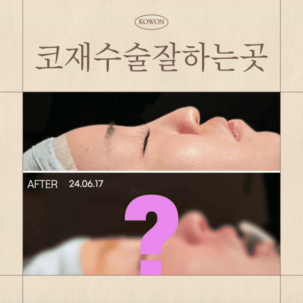 코재수술 상담 전 확인 — 붓기인지 구조 문제인지 구분하는 기준과 재료 선택 관련 이미지 1/7