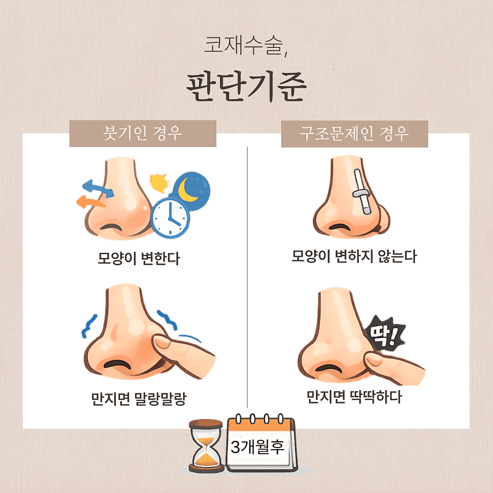 코재수술 상담 전 확인 — 붓기인지 구조 문제인지 구분하는 기준과 재료 선택 관련 이미지 4/7