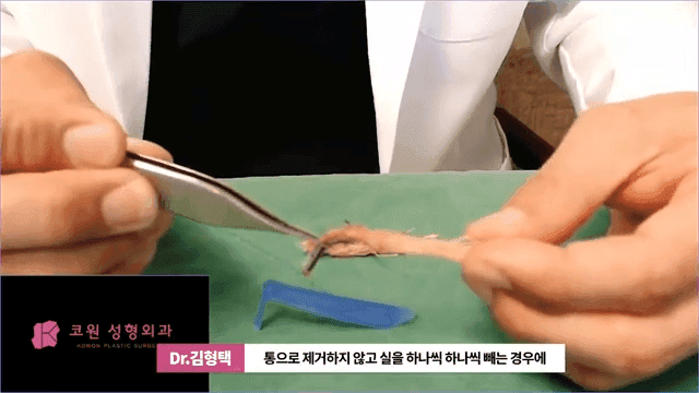 하이코 실리프팅 실제거, 실을 한꺼번에 제거하는 것이 좋은 세 가지 이유 관련 이미지 2/17